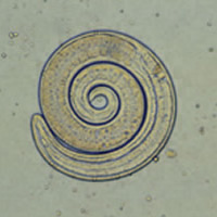 A Trichinella larvae, via Wikipedia.